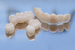 dental crowns and dental bridges
