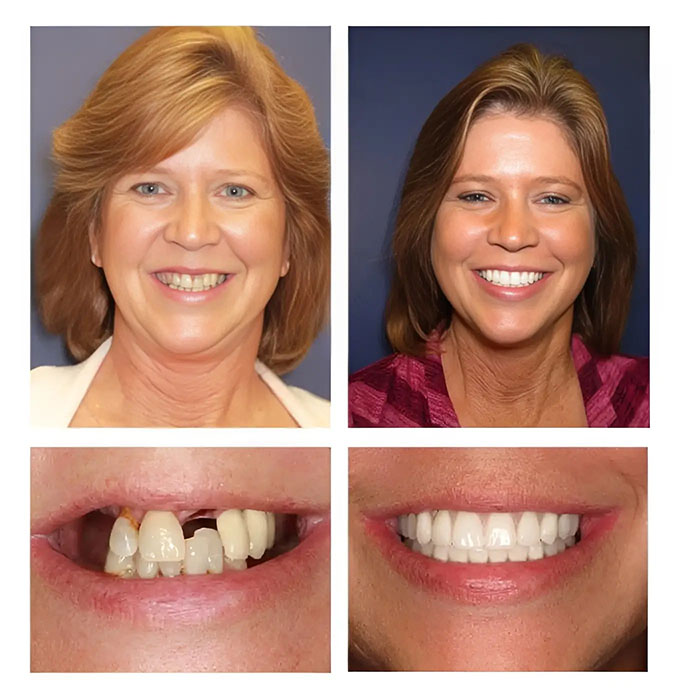 Before And After at PGA Dentistry