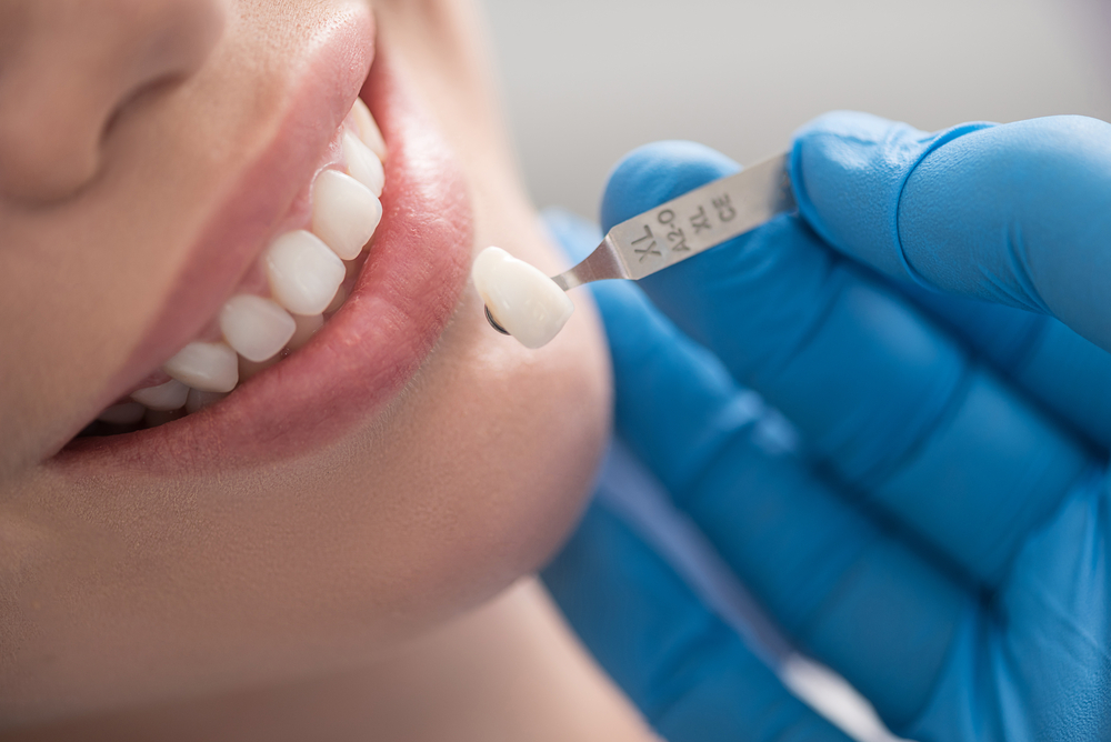 cosmetic dentistry treatments