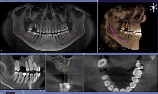 PGA Dentistry 3D CT